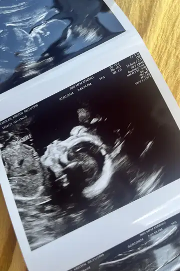 Baby on the way